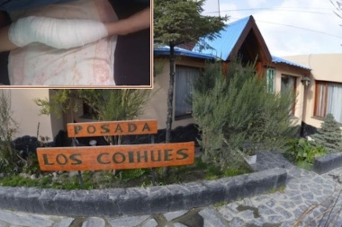 Menor sufrió graves heridas al ser mordida por perros dentro una posada en Ushuaia