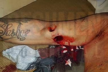 Procesaron con prisión preventiva al joven que agredió de un puntazo con un tubo al boxeador Adrián Garzón