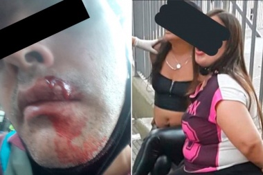 Relato salvaje: Un policía les pidió a dos mujeres que se pusieran el barbijo: lo atacaron a piedrazos y lo enviaron al hospital