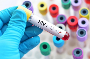 En 2018 se notificaron 40 casos mas de VIH