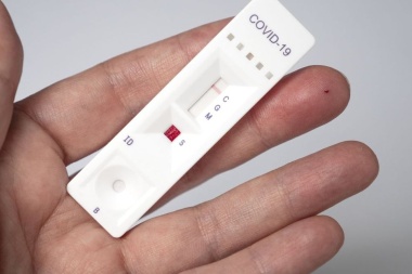 Coronavirus: los autotest estarían para la venta desde enero